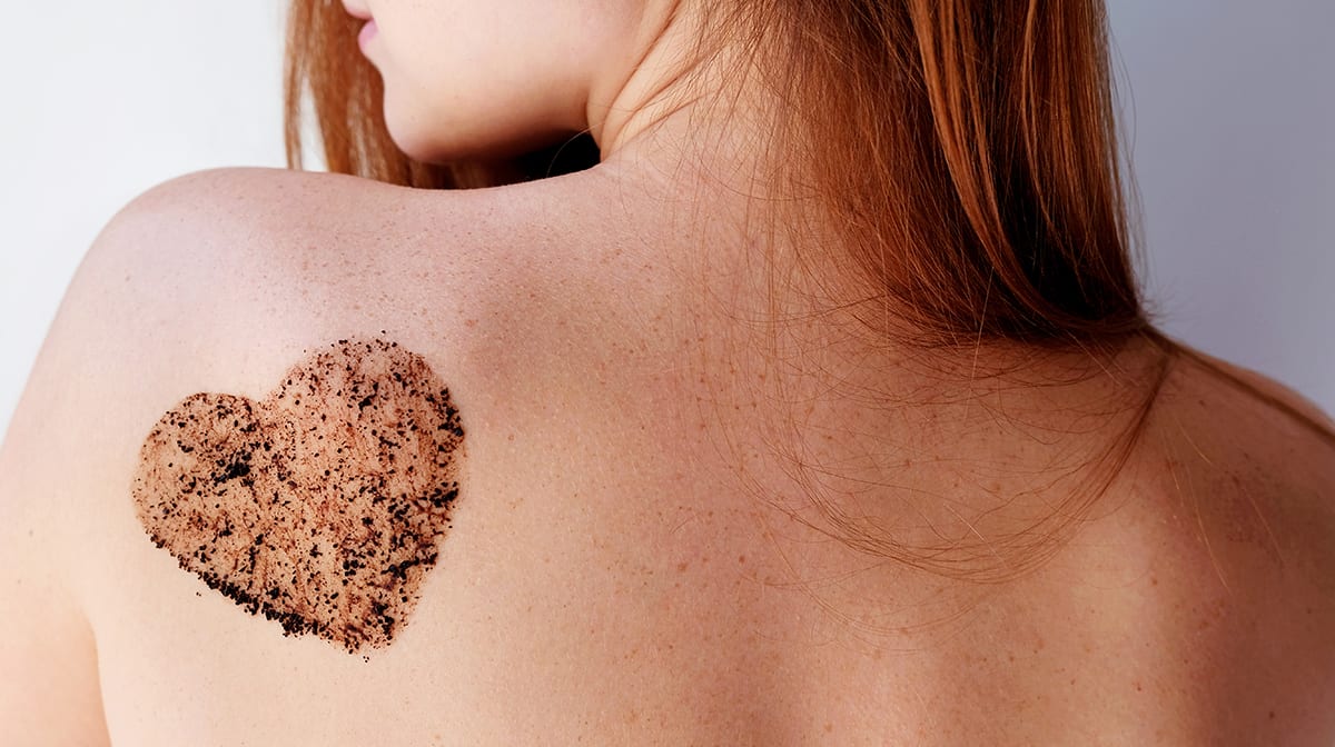 Fix your back acne  before it scars. Here’s how