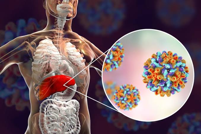 Can Hepatitis D lead to cancer? See what WHO has to say....