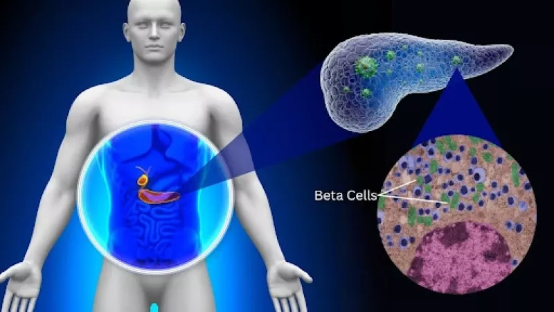 Collagen might be making type 2 diabetes worse, finds study