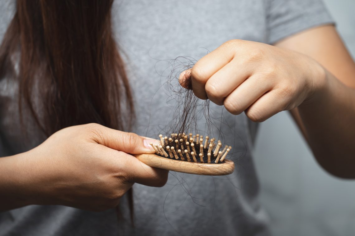 Natural home remedies that may reverse hair loss!