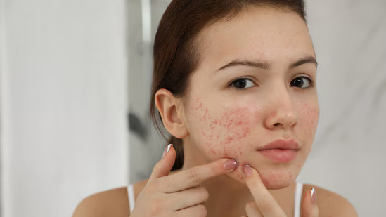 Moved cities & now your skin s freaking out  Here s why