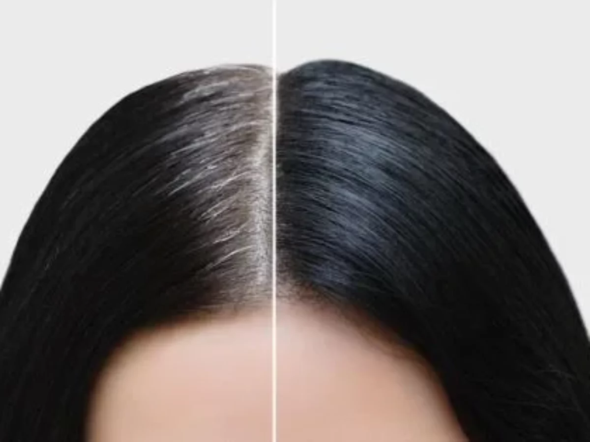 Grey hair at 25? This homemade oil can reverse it naturally!