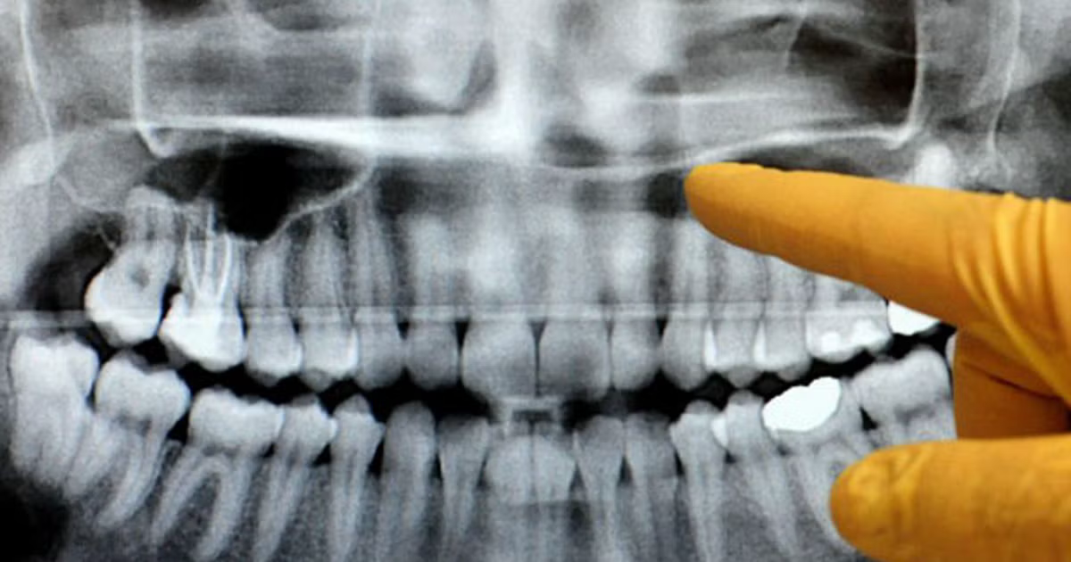 Your mouth can save your life - If you catch this cancer in time!