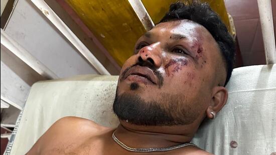 This man walked away from a plane crash that killed 200+, here’s his chilling account