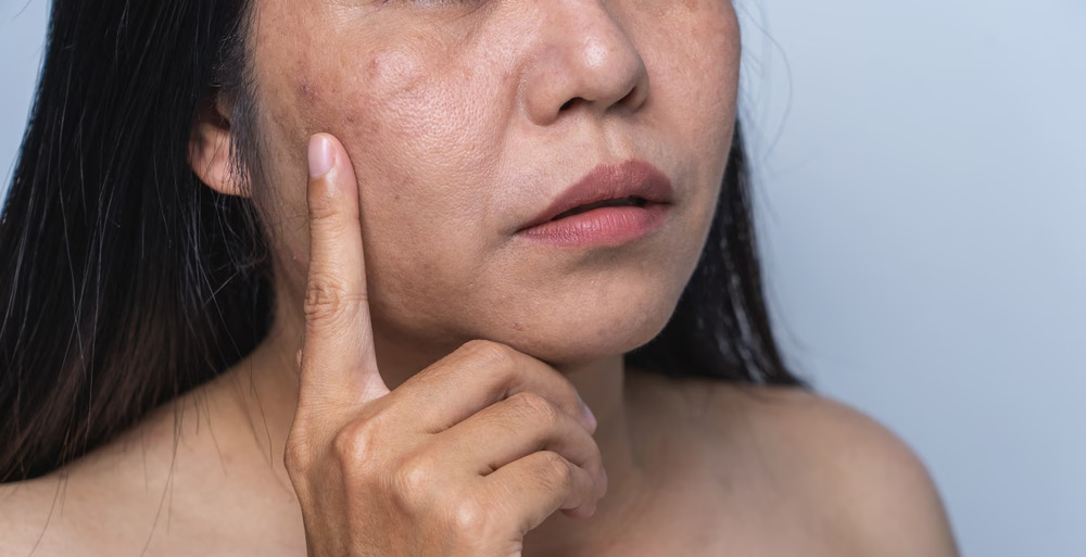 Not just aging  5 skin changes that reveal hidden health issues