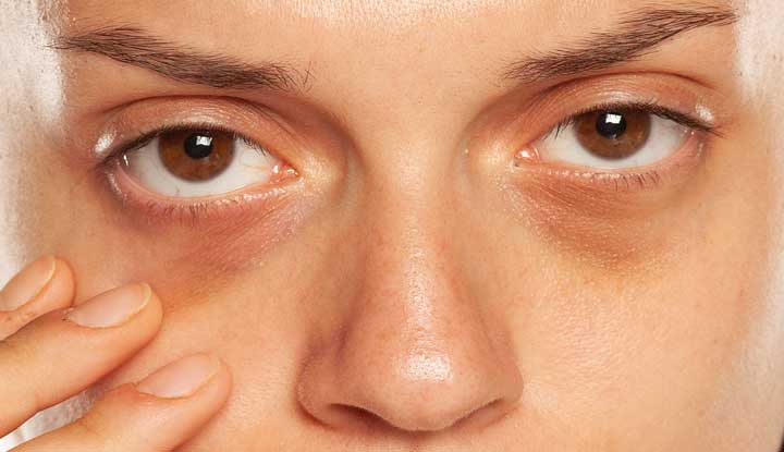 Can peptides really fix under-eye bags?