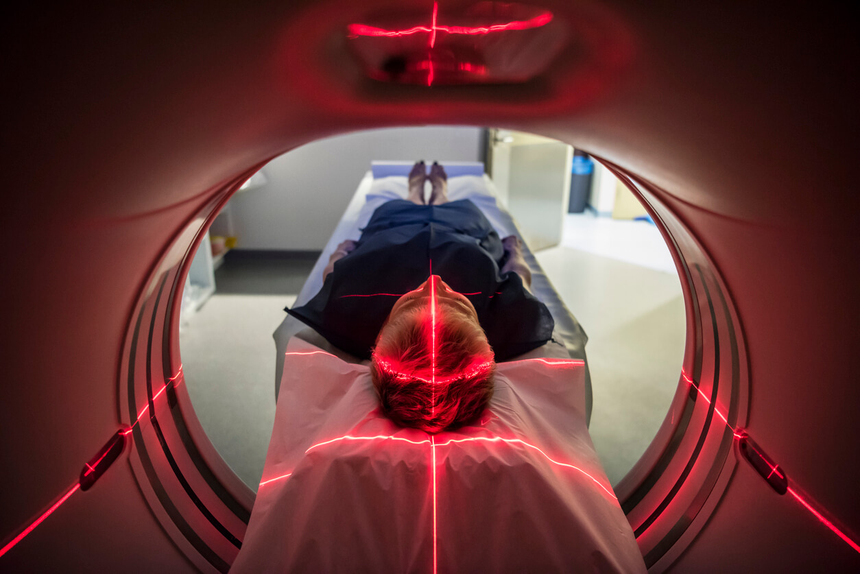 Hidden cancer risks of CT scans: why experts are urging caution